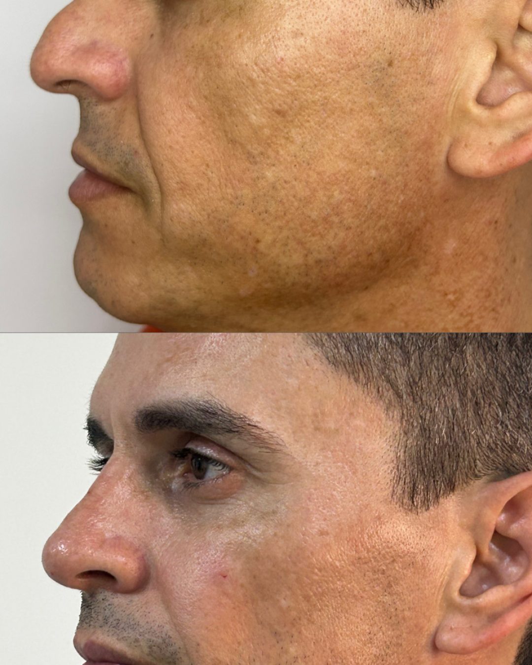 D46BB3F5-8CC4-400F-A989-E88702182FC3